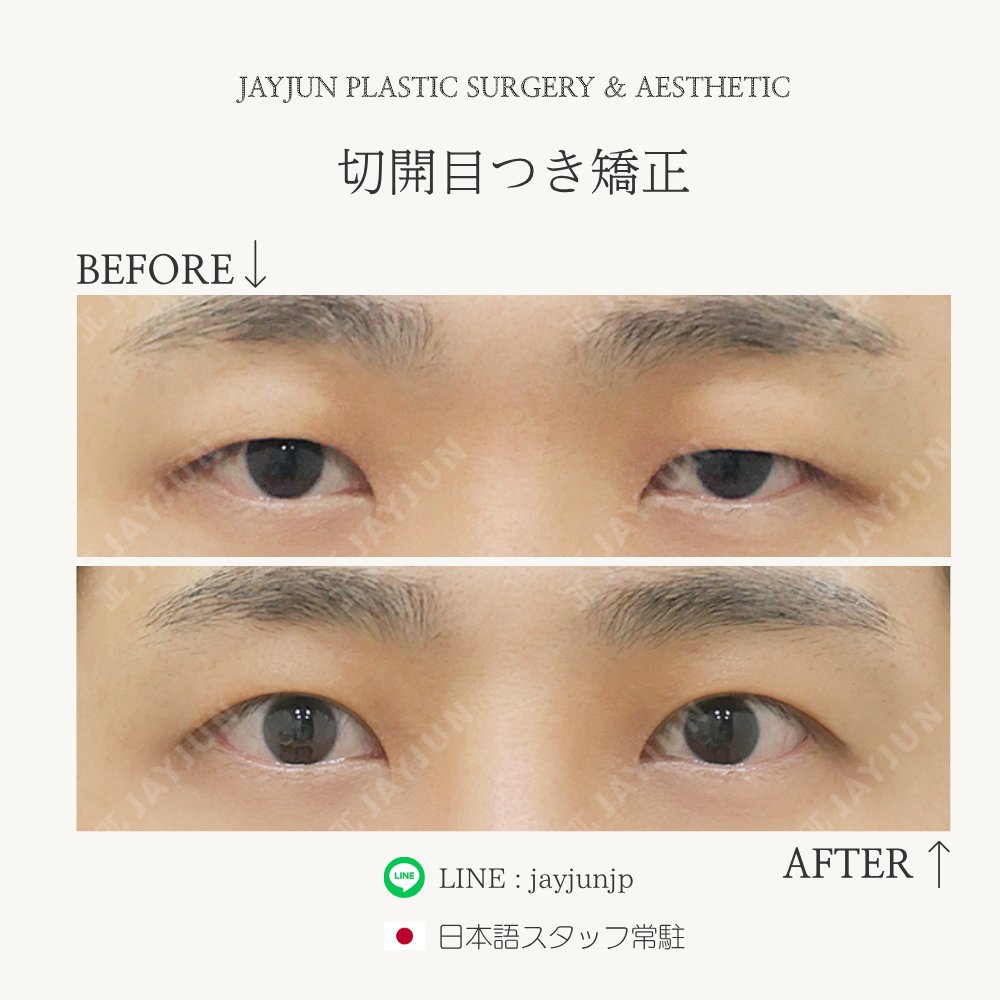 〚公式〛JAYJUN美容外科•皮膚科｜韓国美容 tweet media