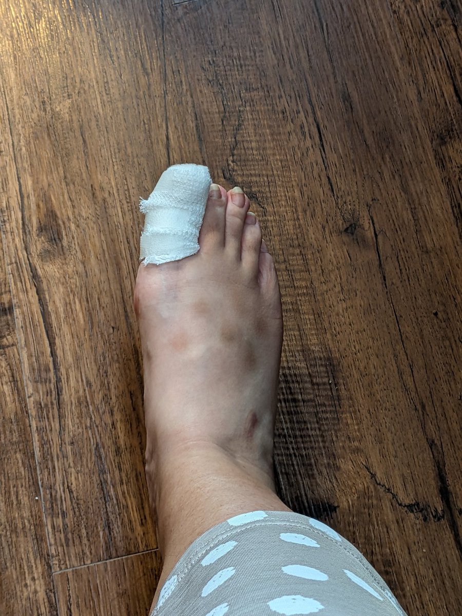 現実に戻されて皮膚科行ってきた🦶