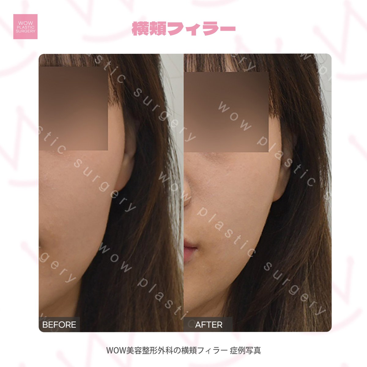 WOW美容整形外科 tweet media
