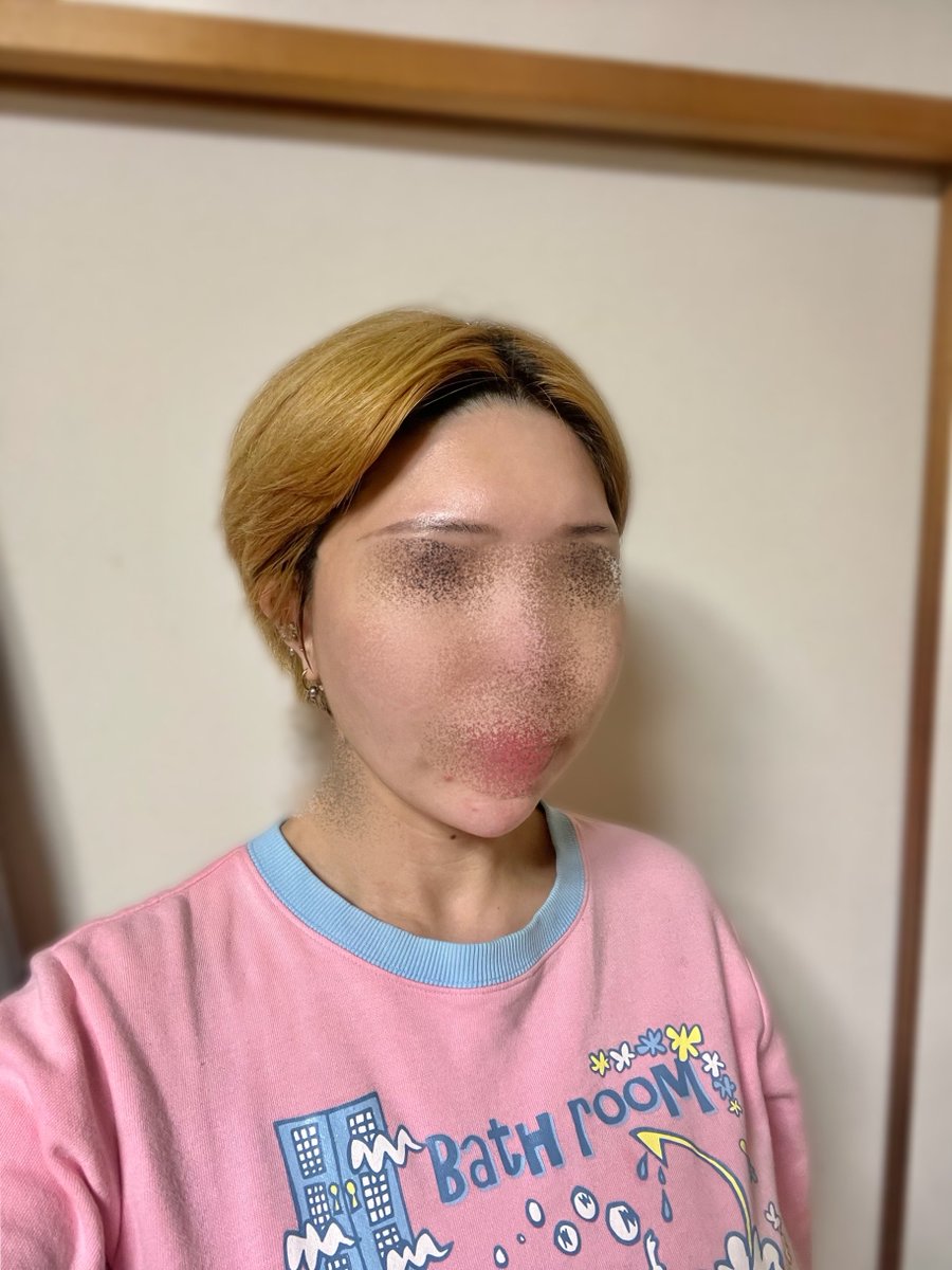 みかん🍊美容 tweet media