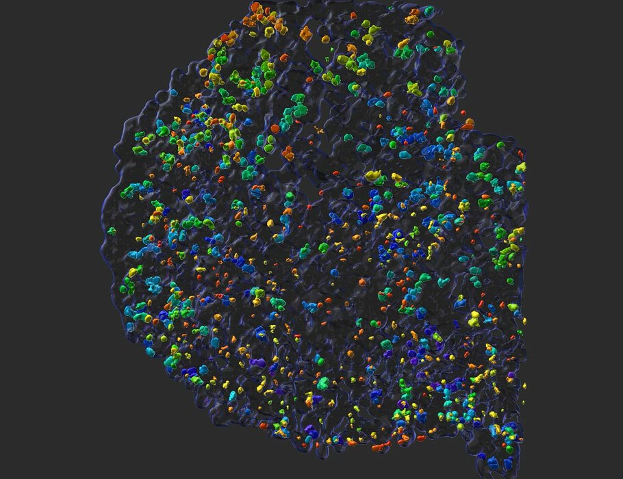 LabWaggoner's tweet photo. CD39+CD49a+CD103+ NK cells, elicited by epithelial tumor cell exposure, can control solid tumors in mice 
https://t.co/TpcooLzLB9 @ScienceTM @JohnSunwooMD @StanfordMed https://t.co/tnkTZN7p13