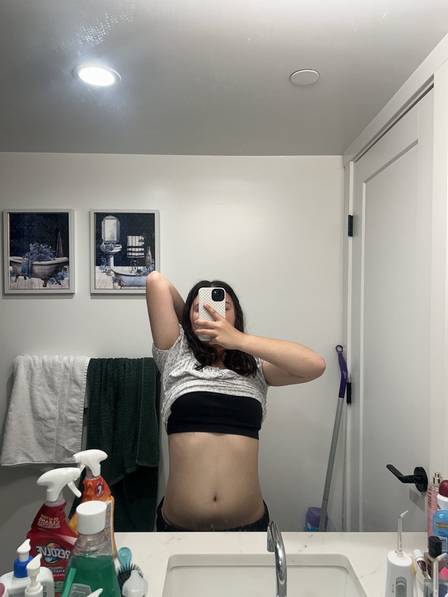 AnaInkDiary's tweet photo. Post Recovery body🫠 I’m relapsing #proana #ed #ananation #relapse https://t.co/KT8sUYZmBo