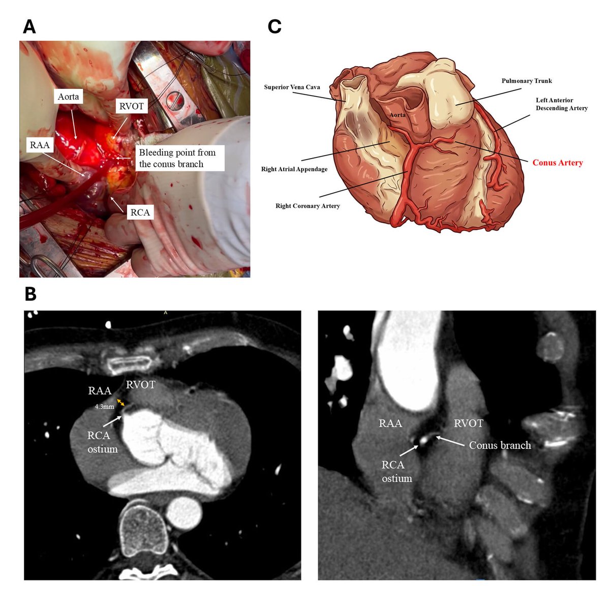 Reviews in Cardiovascular Medicine tweet media