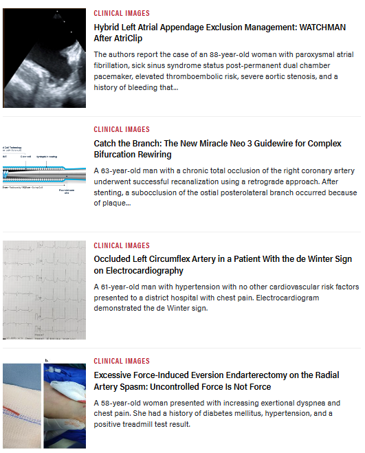 InvasiveCardiol's tweet photo. 📚 The May issue is out now! Read here: https://t.co/DWMtXYQnlT

@Kaitlynkreb @Dr_JHAnderson @jasonwasfy @ktheod2005 @elaaha_a @DLBHATTMD #cardioTwitter #cardioX #cardiology #interventionalcardiology https://t.co/be6yFuAxhh