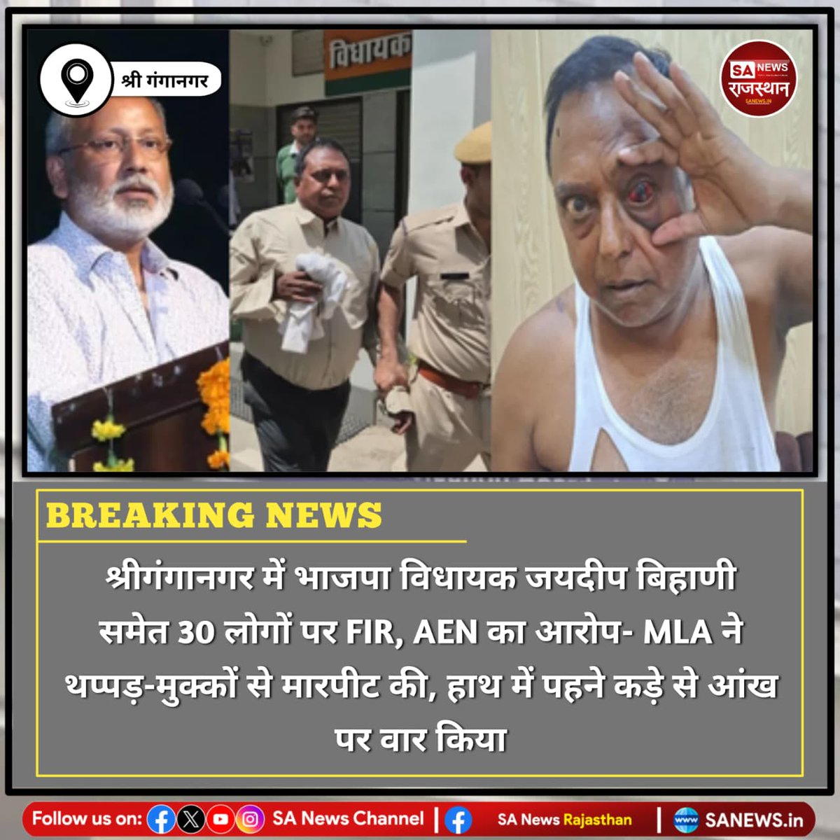 News:- श्रीगंगानगर में RUIDP के AEN जगनलाल बैरवा से मारपीट मामले में भाजपा विधायक जयदीप बिहाणी समेत 30 लोगों पर FIR दर्ज हुई है। एईएन ने विधायक और समर्थकों पर थप्पड़, पाइप से मारपीट और जातिसूचक गालियां देने का आरोप लगाया है। मामले की जांच जारी है।
#Sriganganagar
#JaideepBihani