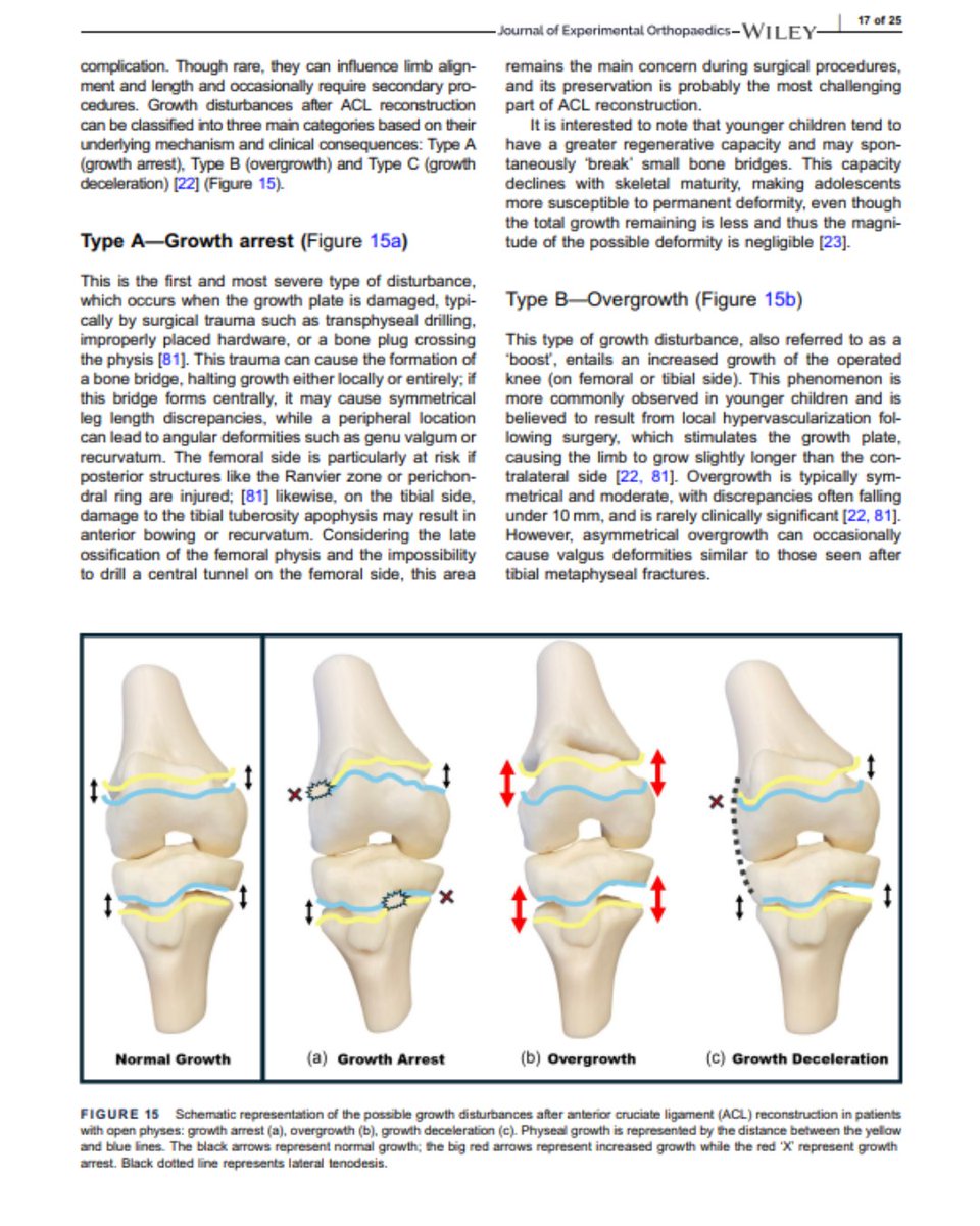 Isokinetic tweet media