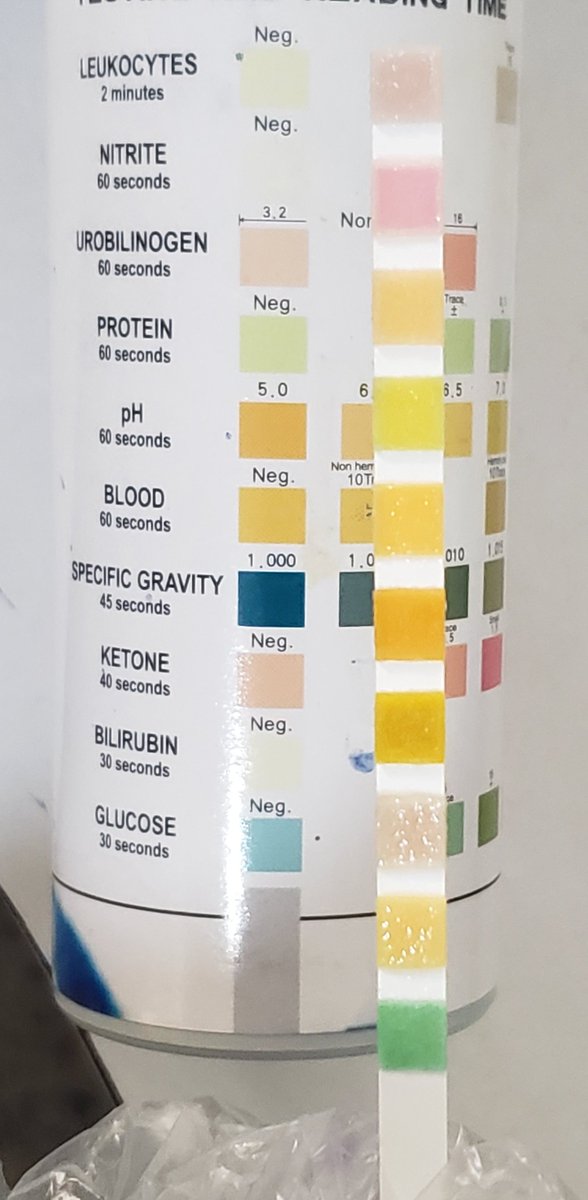 AliAl_khalifah's tweet photo. سؤال طبي ⁉️

امرأة  تبلغ من العمر 50 عاماً خضعت لفحص بول روتيني (Urinalysis)

أظهرت النتائج الفيزيائية 
🧪البول عكر (Turbid)
🧪إيجابية للنيتريت (+Nitrite)

 عند الفحص المجهري وجود بكتيريا بكثافة (+3)

بناءً على هذه الثلاثية (عكارة، نيتريت، بكتيريا)، ما هو التشخيص المرجح للحالة؟ https://t.co/4pHrSy2Ch4