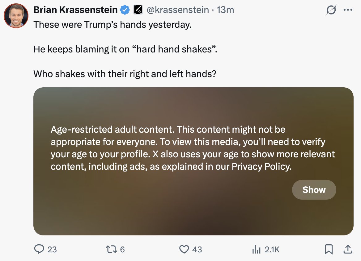 Videographics7's tweet photo. @krassenstein Why is a picture of Trumps hands being age-restricted on this platform? https://t.co/ZUhRY4RpsR