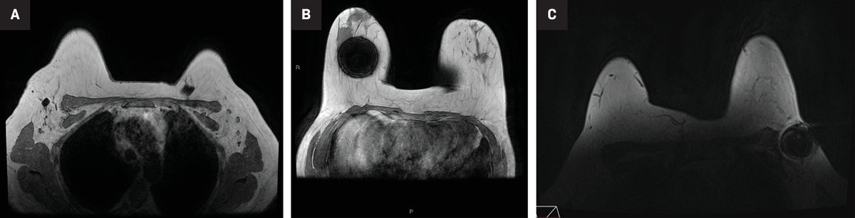AppliedRadiology tweet media