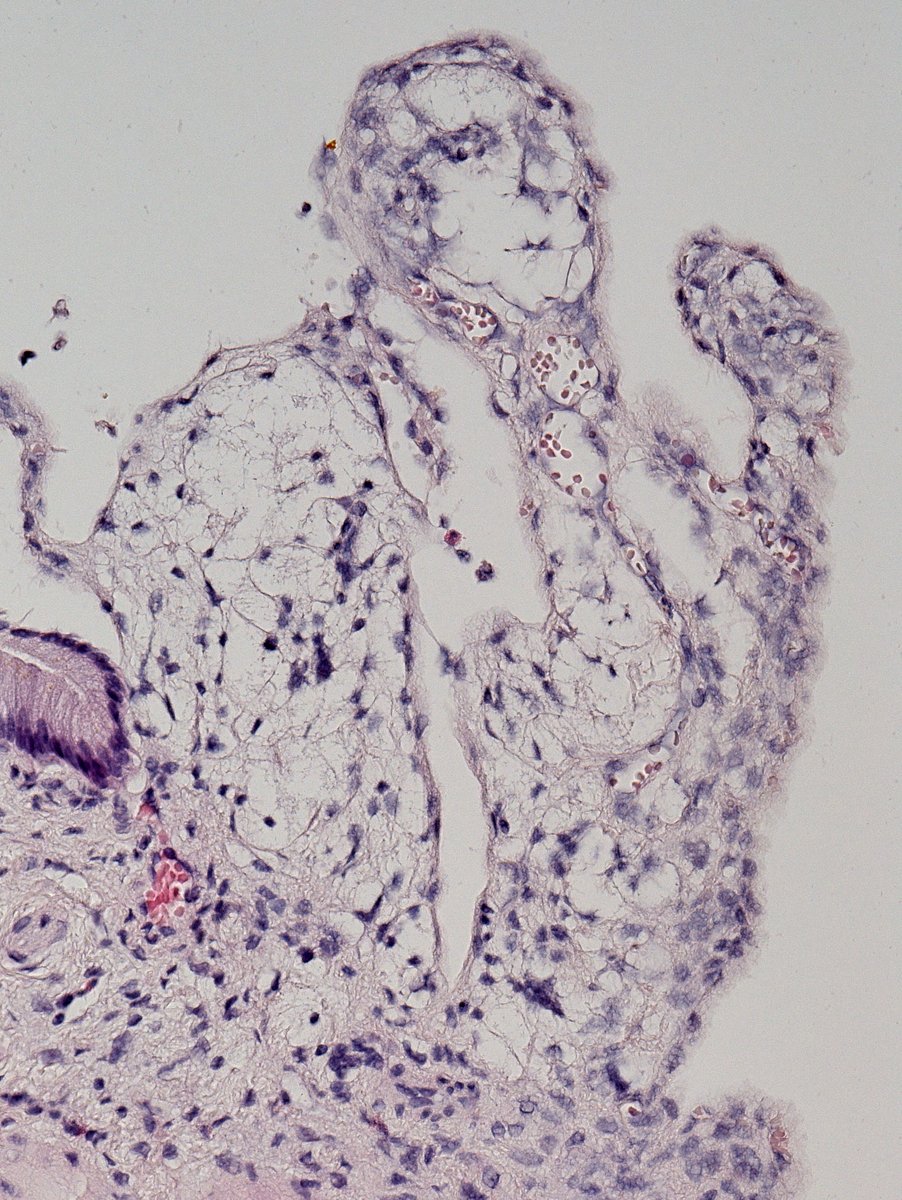 ESP_Pathology's tweet photo. 🔬📸While microphotography is part of daily #pathology practice, an artistic eye can reveal funny images from everyday life!
🗣️I named this one “Politician”, from inflamed gallbladder mucosa.
Prof. Ales Ryska, MD, PhD, Czechia, Past ESP President
#EveryDayPathology
#PathArt https://t.co/vPyZXSlsz3