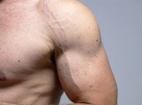 _rookierror's tweet photo. krauser with stretch marks https://t.co/fPkxGjpCiN