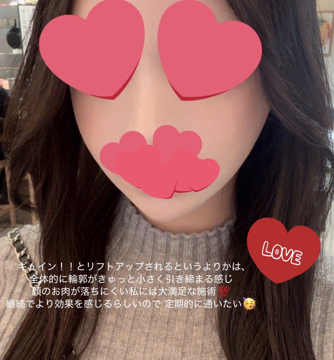 きゅるるん tweet media