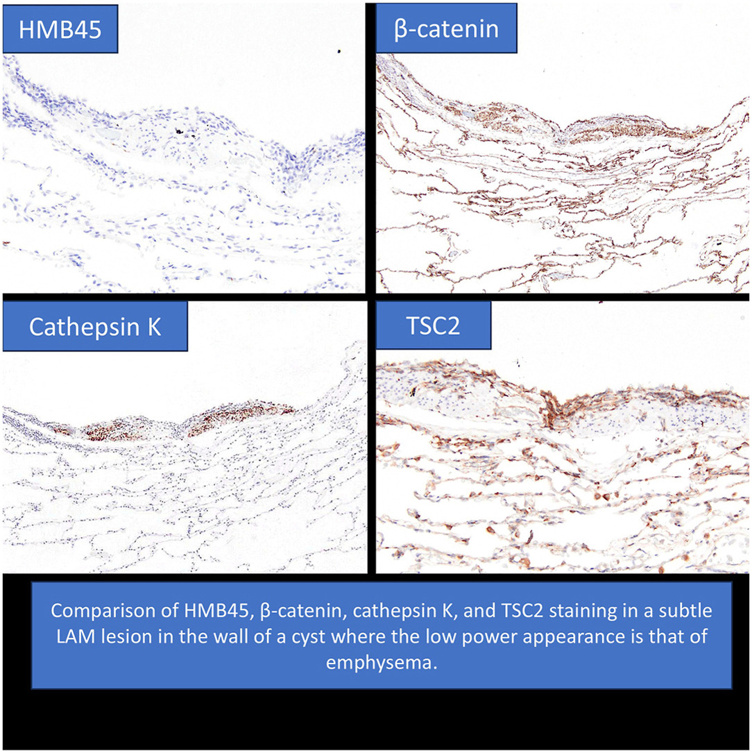Human Pathology tweet media