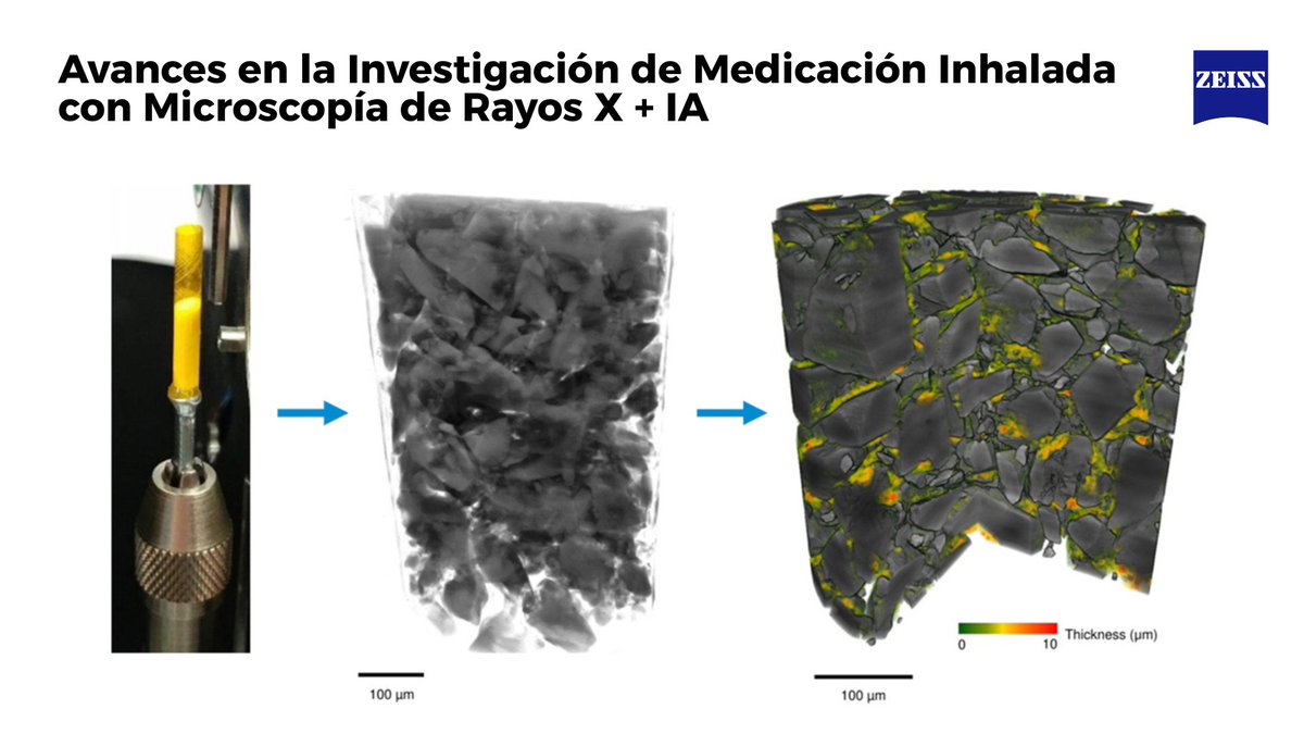 Microscopy_SA's tweet photo. El #SEM mostraba la superficie pero la clave estaba adentro. Microscopía de Rayos X @zeiss_micro + #IA: por fin, una ventana al interior de los inhaladores a escala nanométrica🫁🔬para diseñar terapias respiratorias más eficaces y accesibles!
👉https://t.co/NgUwTwAe3Z https://t.co/5MvJFVtU7G