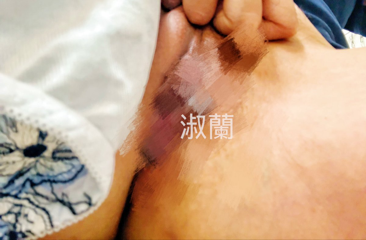 排卵膏內褲2日重 
購買送10/淘汰內衣10淘汰內褲
私@470toffr https://t.co/ZtJhEEEDIv