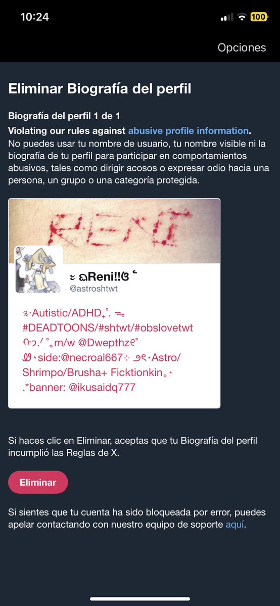 ᭝ ᨳReni!!ଓ ՟ tweet media