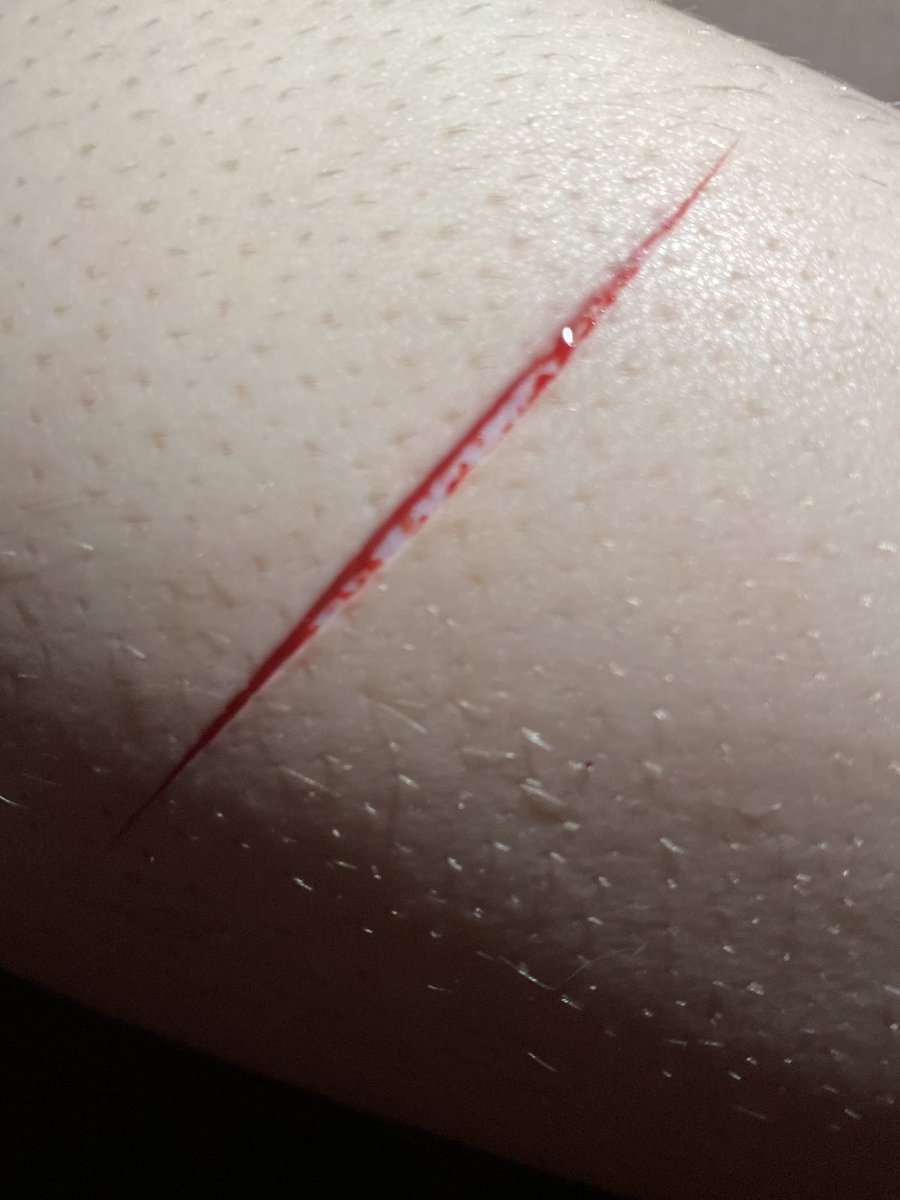 blade352337's tweet photo. i love the second where you cut really deep and no blood comes out
i can see his pretty pink lil insides
#knifeplay #slitwt #slittwt https://t.co/jdXOw9RqZv