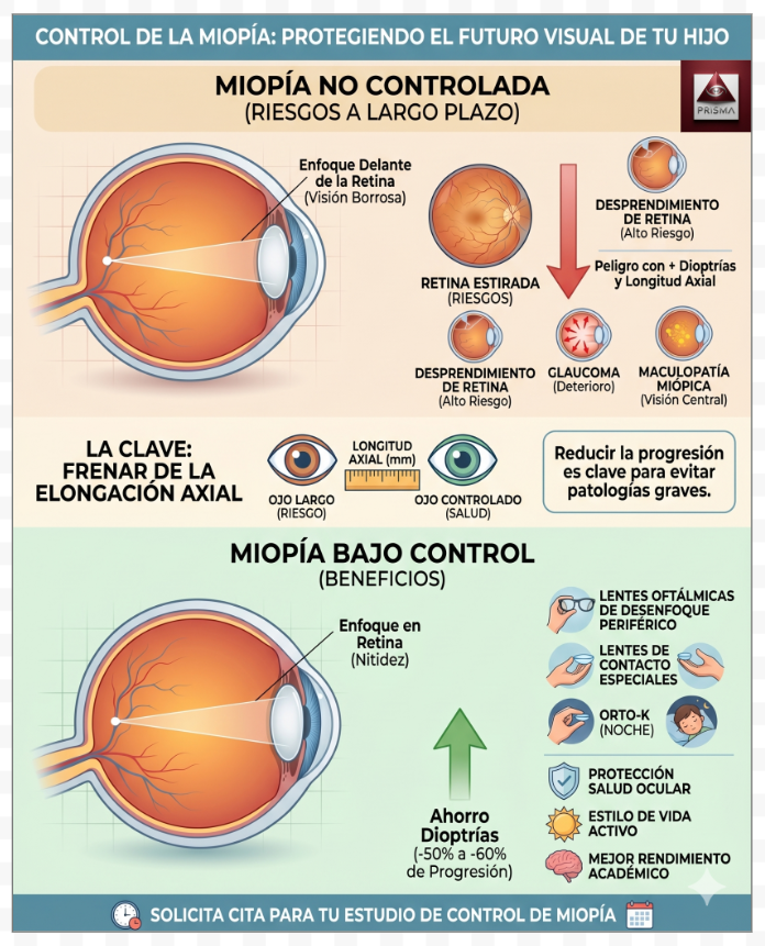 opprisma's tweet photo. Control de la Miopía: Protegiendo el Futuro Visual

El objetivo principal no es solo "ver bien" hoy, sino frenar el crecimiento excesivo del ojo para evitar complicaciones graves en la edad adulta.para evitar patologías graves en el futuro.

en #ópticaPrisma de #SantaPola https://t.co/YWzWaUK8rv