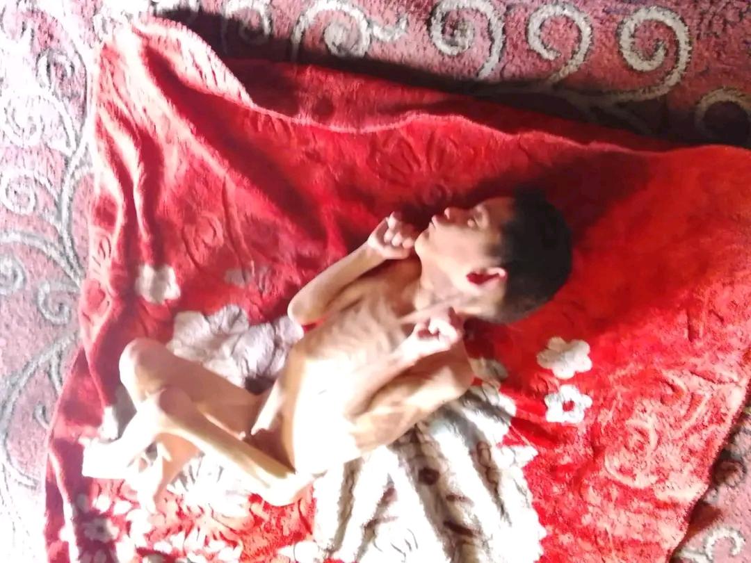 Palestinedaily1's tweet photo. A child with special needs, as you can see in the pictures, suffers from atrophy in Brain, increased electrical activity, and nerve problems..
To donate 👇👇
https://t.co/zZKcCYfvmi https://t.co/HwfGNbOapR
