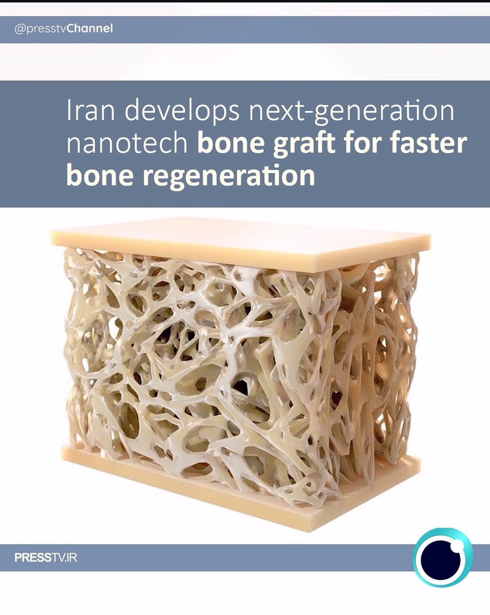 IranFirst_PTV's tweet photo. ‼️Iranian knowledge-based company develops next-generation nanotech bone graft for faster bone regeneration

https://t.co/Ulhv8Egygz

#IranFirst https://t.co/mmyHhJDpOC