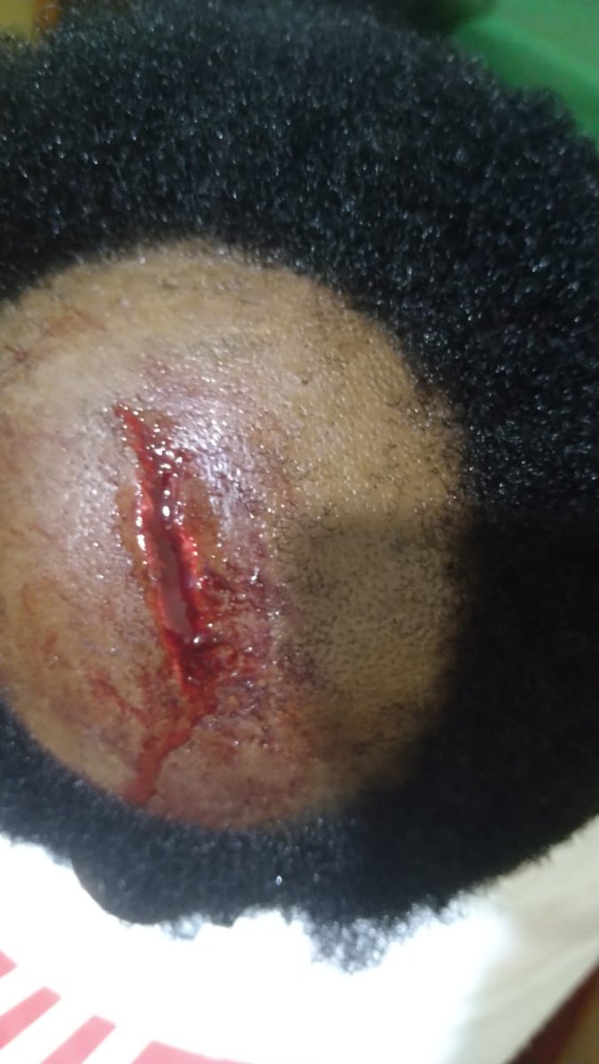 hategekimanadid's tweet photo. 🚨AMAKURU MASHYA🚨
 Abanyeshuri babiri b'Abakobwa biga mu kigo cya EAV /GITWE giherereye mu karere ka Ngoma mu murenge wa Rukira batawe muri yombi nyuma yo gukubita bakanakomeretsa bikabije umuyobozi wabo ushinzwe imyitwarire (Animatrice)
Kuri ubu bari mumaboko ya  RIB https://t.co/3dkAN7kRfQ