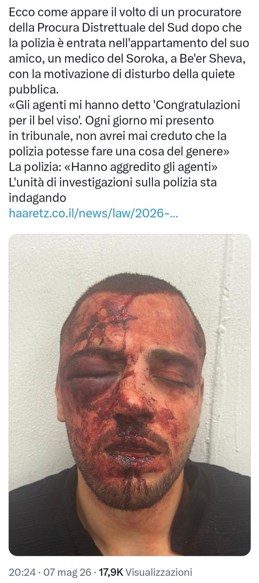 Ecco come appare il volto di un avvocato palestinese israeliano,dopo che la polizia ha fatto irruzione nel suo appartamento, sostenendo di essere disturbata dal rumore, per poi picchiarlo e arrestarlo insieme ai suoi parenti.
Sono questi i pari diritti in Israele <a href="/DAVIDPARENZO/">David Parenzo</a> ?