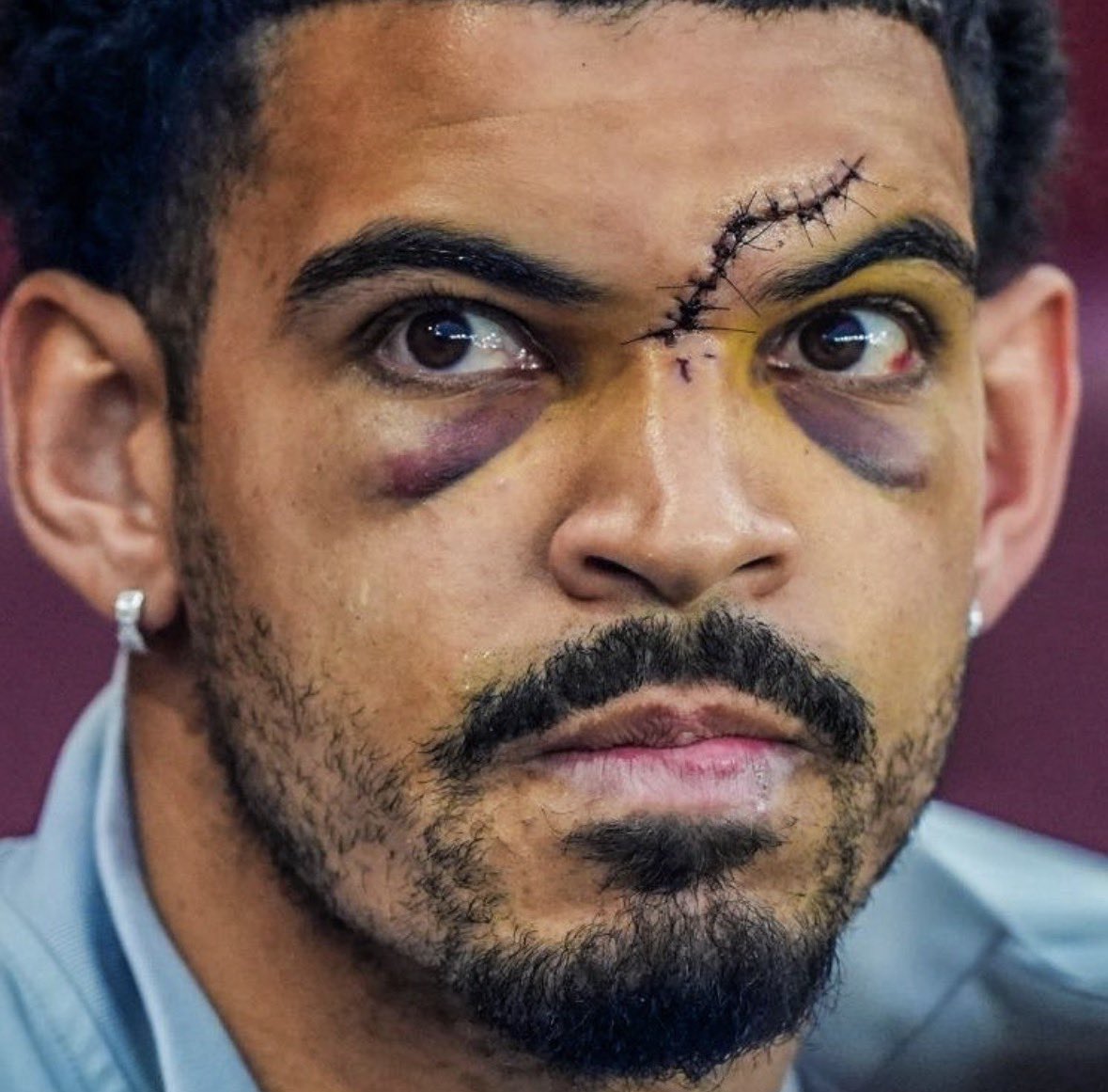 I knew Morgan Gibbs-White’s injury was bad but jesus…