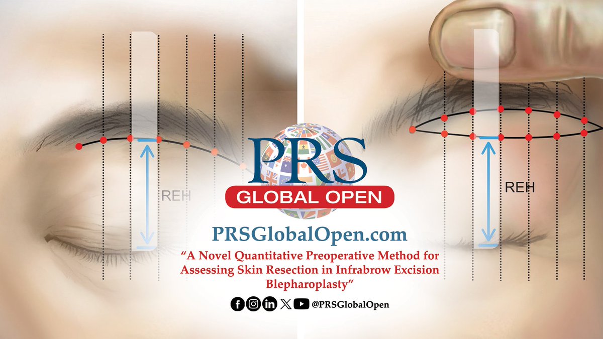 PRS Global Open tweet media