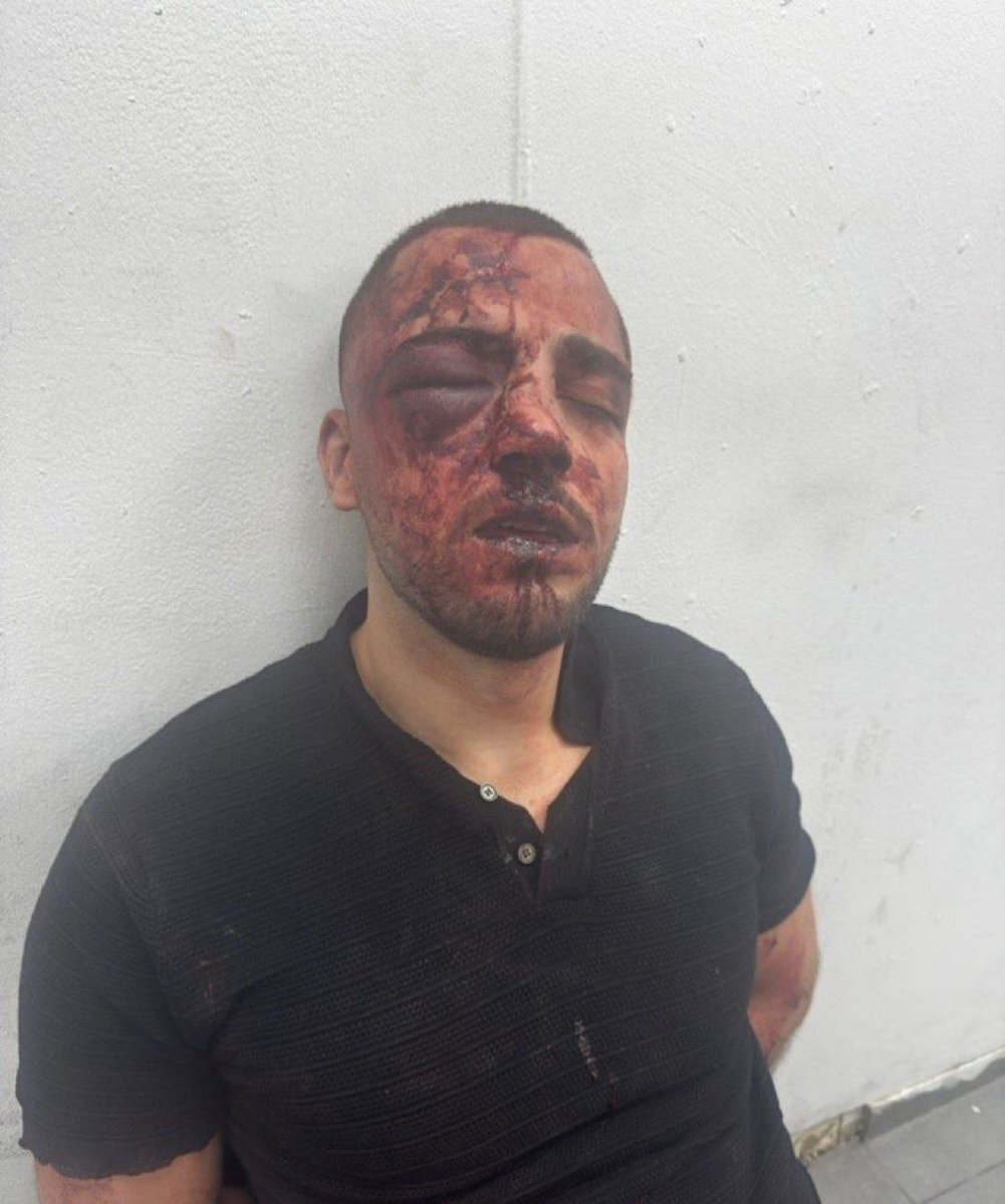 🇮🇱 👮‍♀️ FLASH — Le procureur Salah Khalil Faisal Naama a été violemment agressé à son domicile par des forces de police israéliennes. 

Ces dernières ont pénétré sans aucun mandat dans sa résidence suite à une plainte pour tapage nocturne et l’ont roué de coups avant de l’embarquer