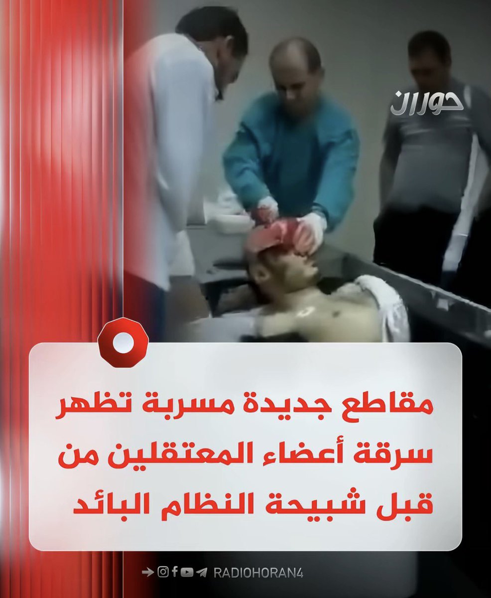Kuwaity__7r's tweet photo. تسريبات فيديوهات مشفى #تشرين في سوريا مؤلمة جدا ، نظام الاسد الوحشي كان يسرق أعضاء المعتقلين السوريين بعد أن يقتلهم ويببعها في السوق السوداء! ، هذا جزء بسيط من جرائم الاسد وحزباله وإيران وبالاخير يقولون أن هؤلاء هدفهم تحرير الاقصى ومساعدة المسلمين ، لعنة الله على إيران ومن يدعمها https://t.co/lzWBYGneZH