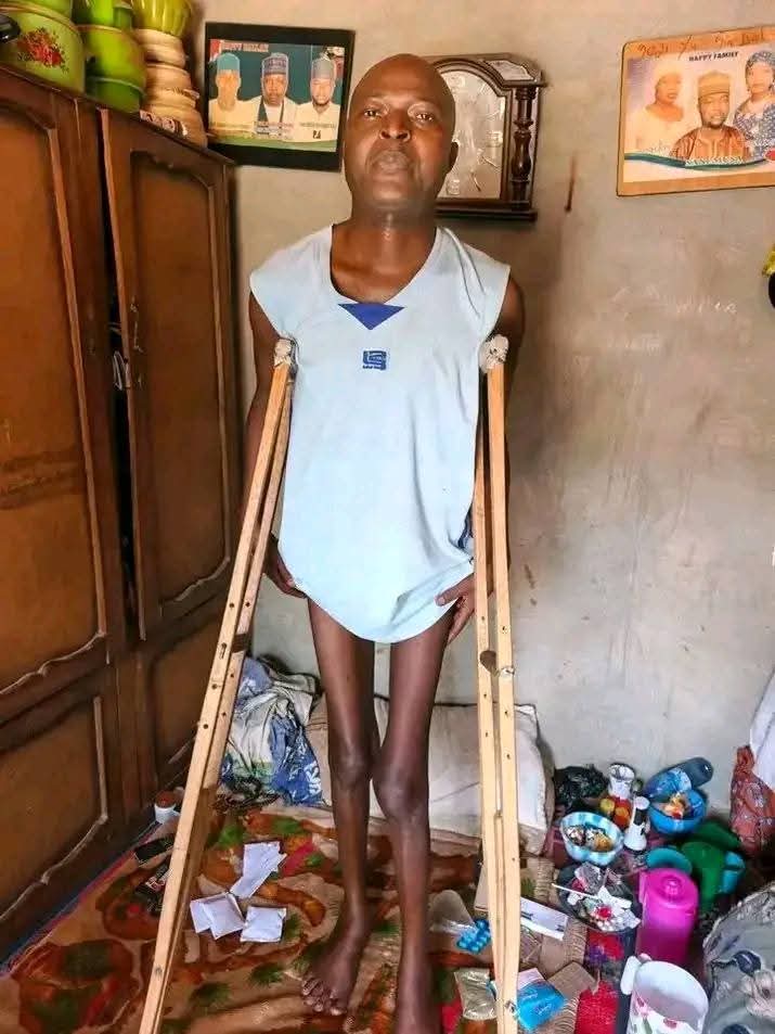 This is Road Safety Officer Sani Musa’s before-and-after pictures. Due to his current condition, Musa cannot walk without support. The government does not care, and the FRSC has also failed to care for him despite all his sacrifices in the line of duty before he became sick and