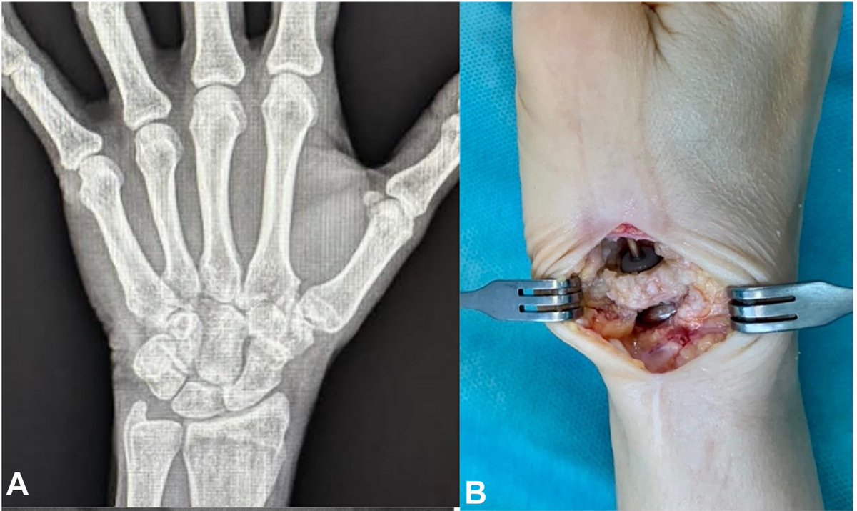 J Hand Surg Am- ASSH tweet media