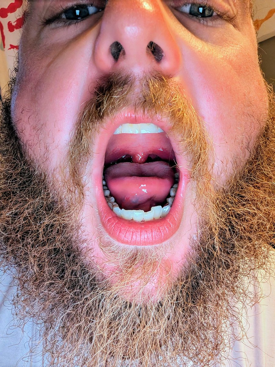 HairyBear tweet media