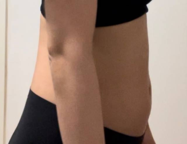 LE_ROSE_JP's tweet photo. お客様の6ヵ月目コメント：         

手術後、お腹のラインがすっきり整ったのを見て、本当に感動しました！

回復の過程でも特に大きな不便はなく、医療スタッフの皆さんが継続的に状態をチェックしてくださったので安心できました。

今ではお腹のラインがとてもきれいになり、自信もつきました！ https://t.co/xD2CTjB5ex