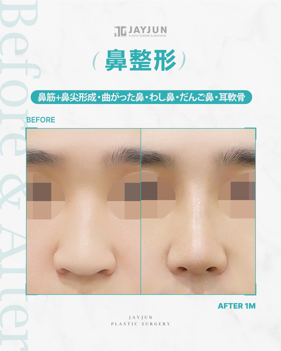 〚公式〛JAYJUN美容外科•皮膚科｜韓国美容 tweet media