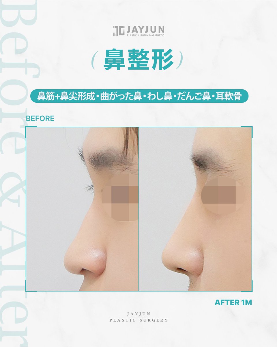 〚公式〛JAYJUN美容外科•皮膚科｜韓国美容 tweet media
