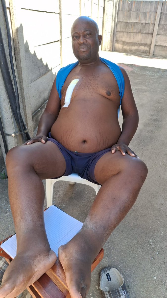 DandaroOnline's tweet photo. #dandarostreets
Received in our DM:

🙏 URGENT HELP NEEDED FOR A LOVING FATHER 🙏

Life can change in an instant. Philemon Mudzingwa, a devoted father and hardworking family man, is currently battling Stage 5 kidney disease — the most severe stage of kidney failure. 💔

Phil now urgently needs ongoing dialysis and a life-saving kidney transplant. As the main provider for his family, the emotional and financial burden has become overwhelming.

His treatment journey includes:
* Kidney treatment costs – $15,000
* Flights to India – $1,000–$1,500 per person
* Accommodation – $20/day for 6 weeks
* Food & groceries – $250/month
* Transport – $200

Every contribution, no matter how small, brings him one step closer to survival and recovery. If you cannot donate, please share this post — your share could reach someone who can help. ❤️
💸 EcoCash Donations: 0772356772
📞 Contact: 0772356772

🔗 Donate here: https://t.co/k1KNnJ65yZ

Let’s come together and give Phil a fighting chance to continue being there for the people who love and depend on him. 🙏❤️

#SavePhilemon #KidneyTransplant #DonateAndShare #TogetherWeCan #HelpSaveALife