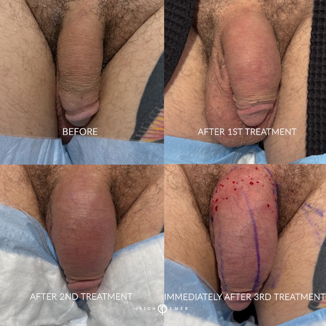 JasonEmerMD tweet picture