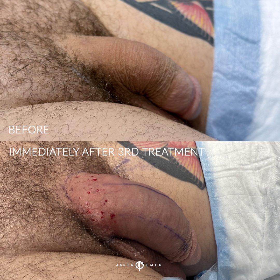 JasonEmerMD tweet picture