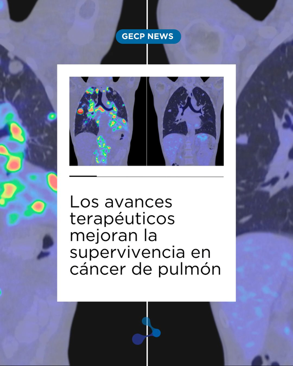 gecp_org's tweet photo. El cáncer de pulmón sigue siendo una de las principales causas de mortalidad por cáncer.
Los avances en tratamientos están cambiando el pronóstico 👇
➡️ Más investigación
➡️ Más prevención
➡️ Más concienciación https://t.co/GbfiLhVjTP