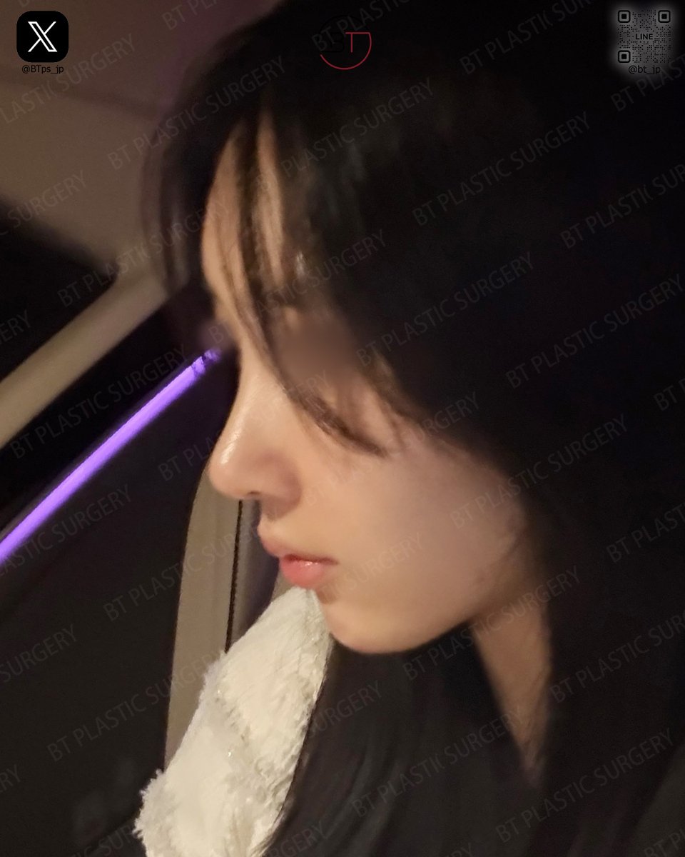韓国BT整形外科「輪郭と鼻手術専門」 tweet media