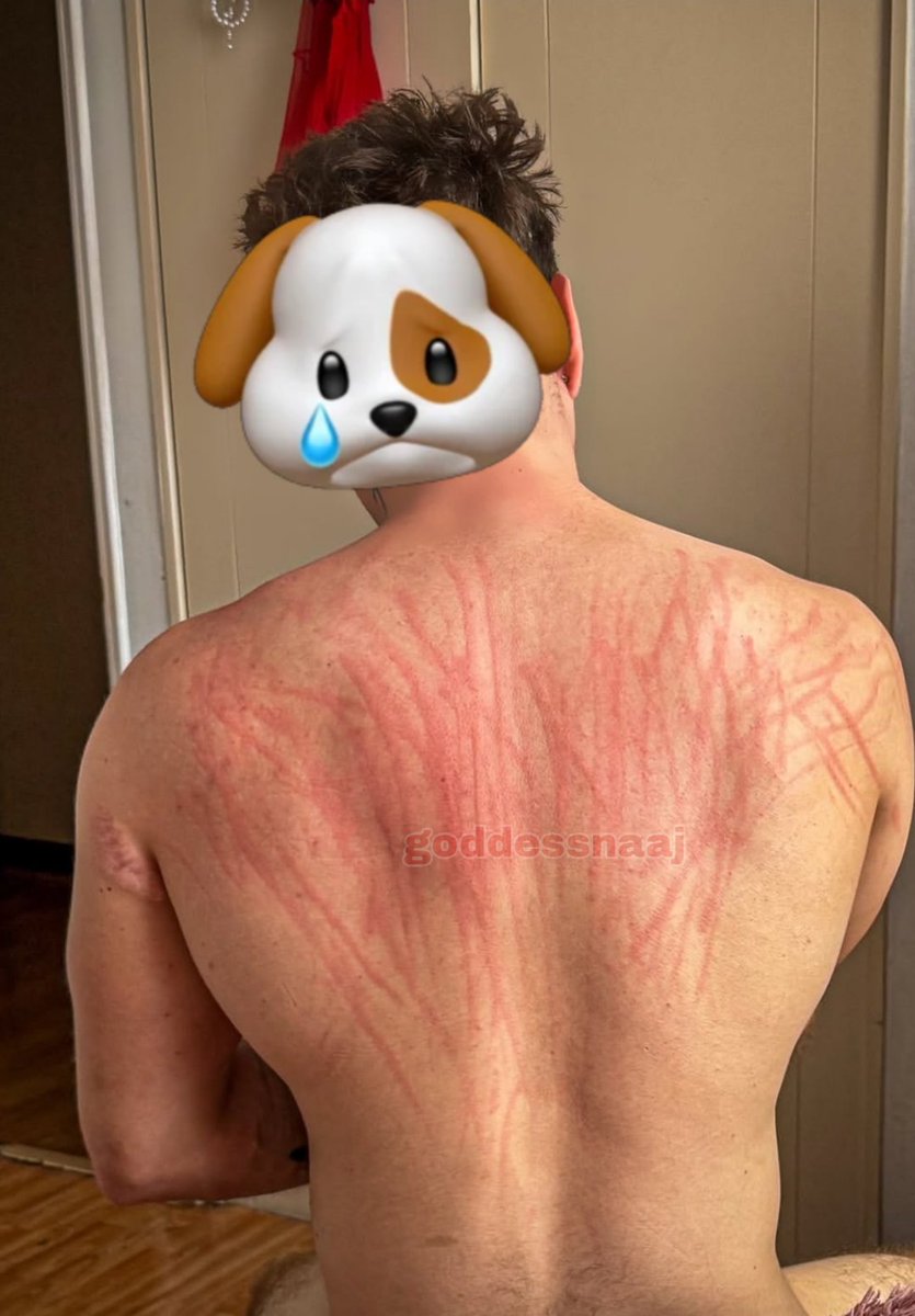 goddessnaaz's tweet photo. Not every slave is lucky enough to have my nail marks on their body.
Who wants my nail marks on their chest? Bark on comment...🐶 https://t.co/nVgKr4s83z