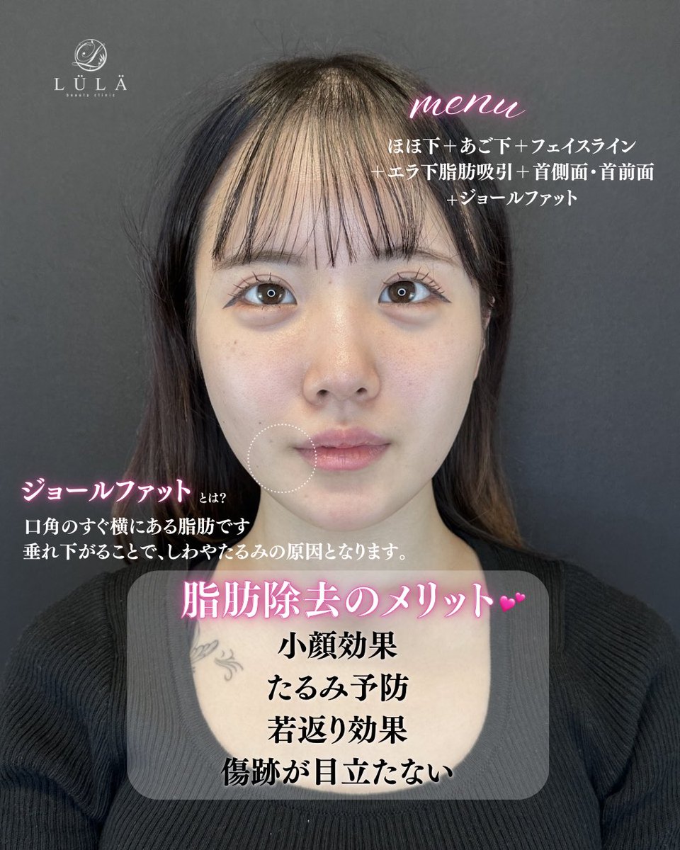 ルラ美容クリニック心斎橋院 tweet media