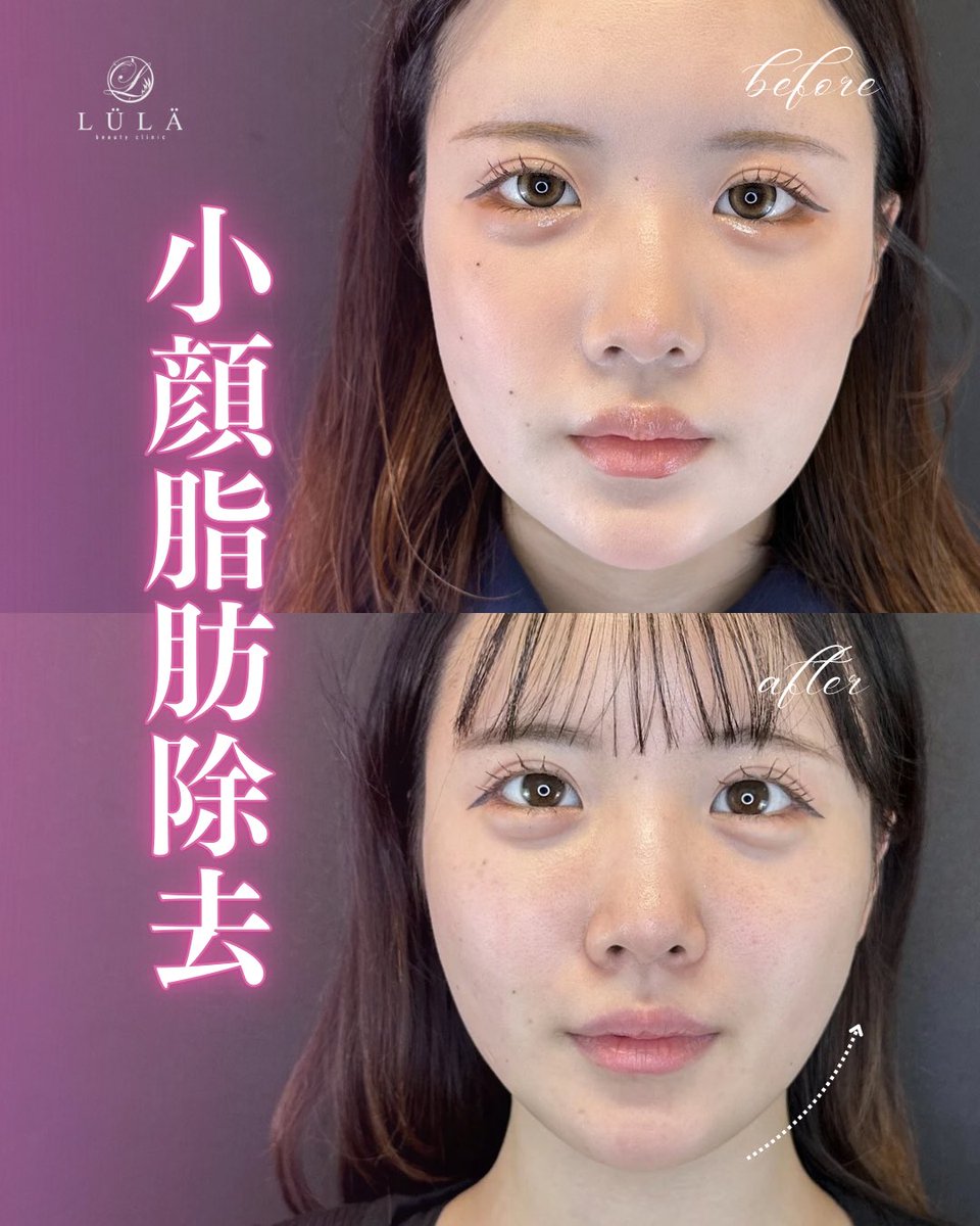 ルラ美容クリニック心斎橋院 tweet media