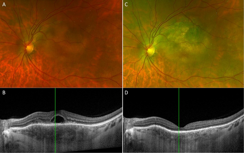 Clinical and Experimental Ophthalmology tweet media