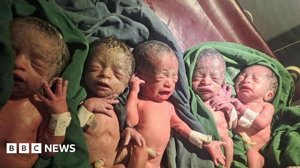 A woman has given birth to rare quintuplets in Ethiopia's Harari Regional state after 12 years of trying for a baby.

Bedriya Adem said she and her husband were "overjoyed" to be "blessed with five children at once".
bbc.in/4evDYSI
