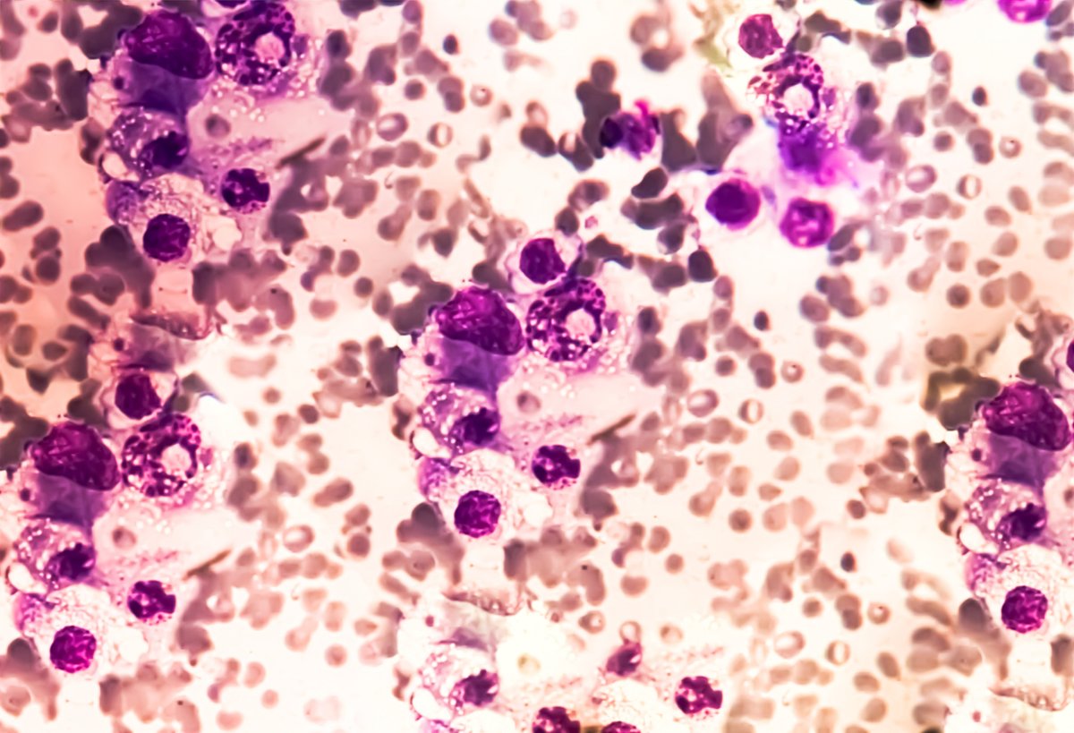 BFHU1925's tweet photo. A new HU study has led by Prof Aqeilan, the research shows how the protein WWOX stabilizes p63, helping preserve skin cell identity and block the dangerous spread of tumours
https://t.co/5FztpoTQ24 https://t.co/VetdBRm0DK