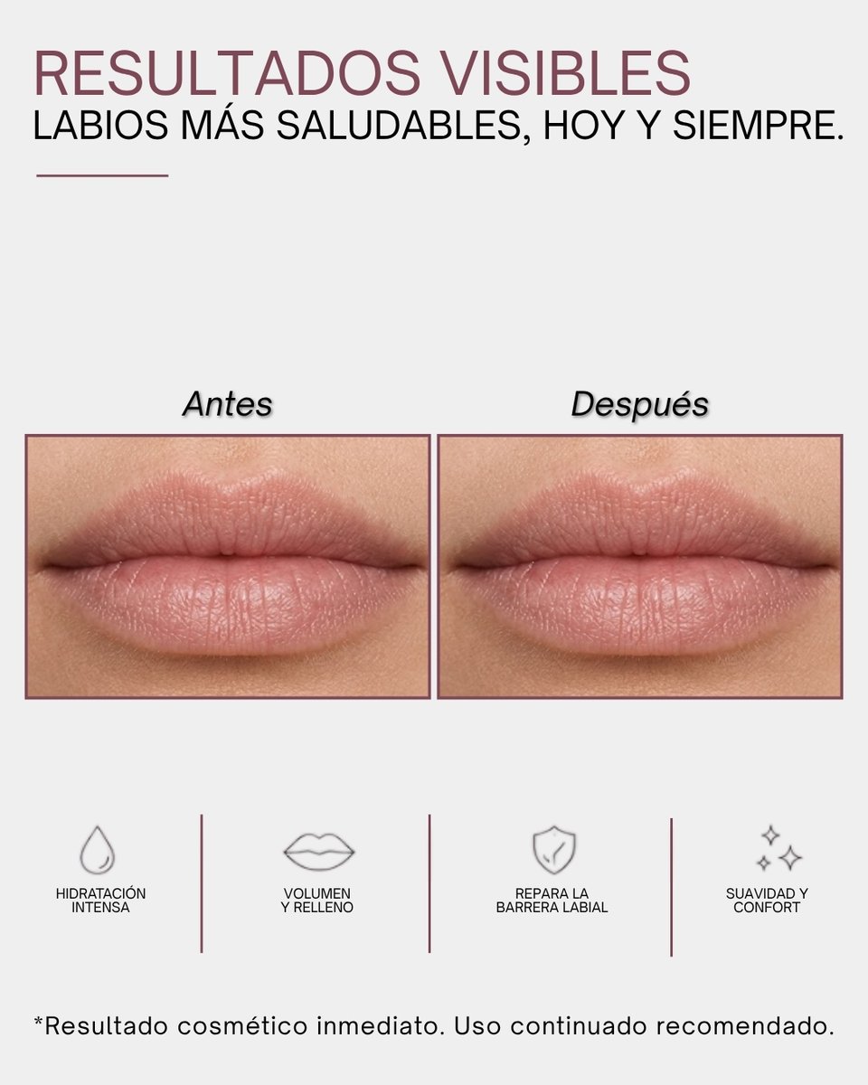 zakcosmetics's tweet photo. Ciencia dermoestética para tus labios.

Tratamiento con péptidos, ácido hialurónico y ceramidas.  Repara la barrera cutánea, estimula el colágeno y aporta volumen inmediato.

Resultados visibles. https://t.co/HjKtjpsLP4