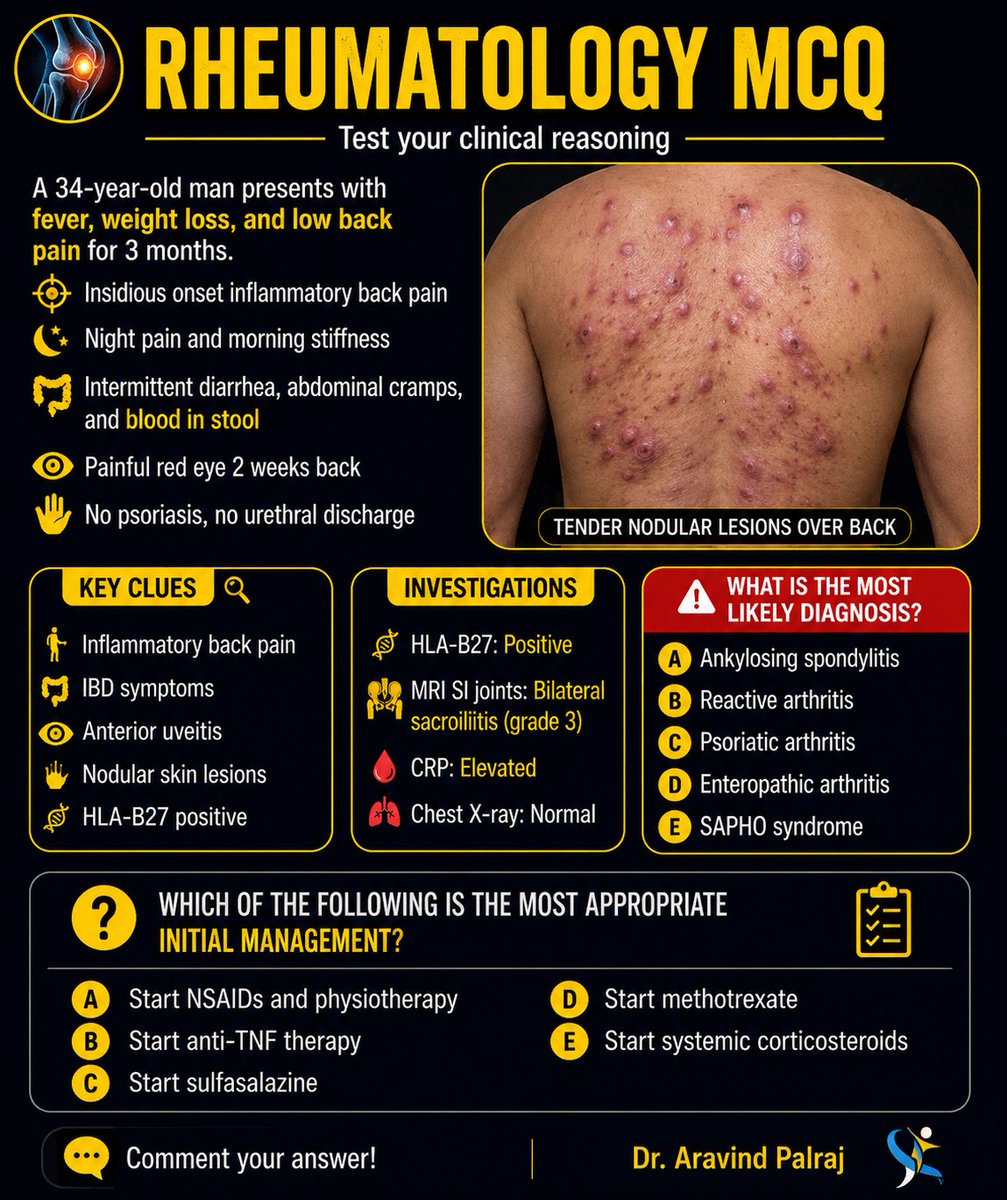 Rheumat_Aravind's tweet photo. HLA-B27 positive + sacroiliitis 👀

But the real clue is:
bloody diarrhea + uveitis + nodular skin lesions

Dx?
Best initial management?

👇

#Rheumatology #SpA #IBD #MedEd @docakx @IhabFathiSulima @DocPriyamMD @DrNikhilMD @ArunInamadar #ClinicalReasoning #RheumTwitter https://t.co/CJ81HuyW3I