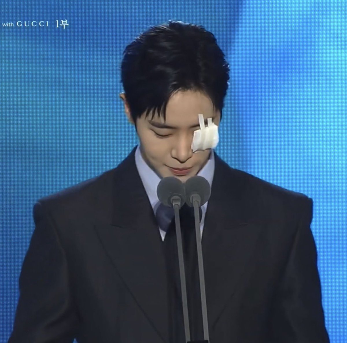 눈 왜그래....ㅠㅠ